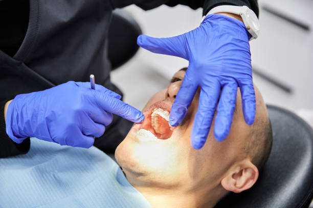 Best Emergency Treatment for Dental Infections or Abscesses in Helena West Side, MT